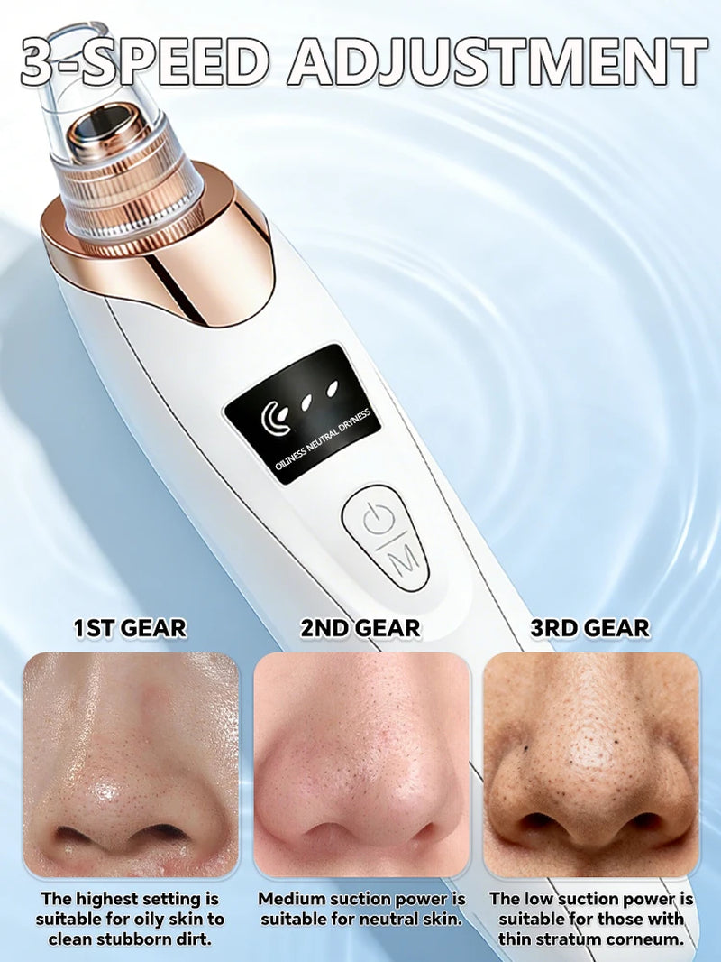 Blackhead and Blemish Removal Blackhead Remover Mask-Pore Vacuum-Blackhead Remover-Nose Blackhead Remover- in Stockfast Shipping